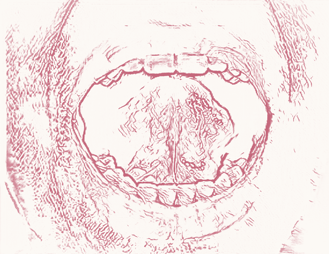 Lingual Frenulum