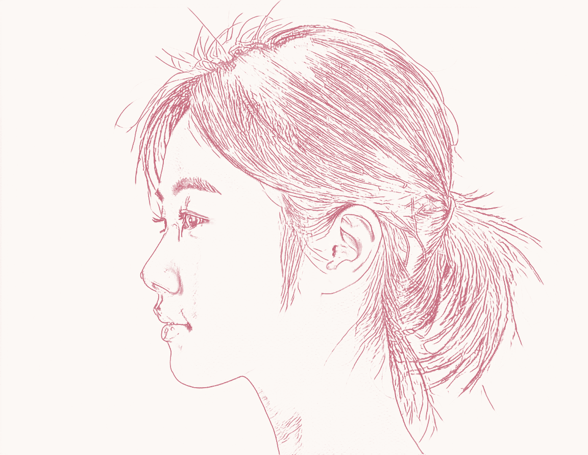 Cheek